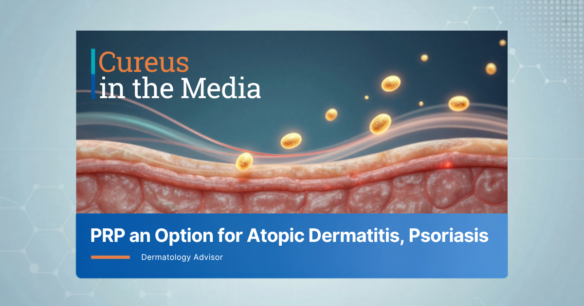Curious in the Media PRP for atopic dermatitis psoriasis